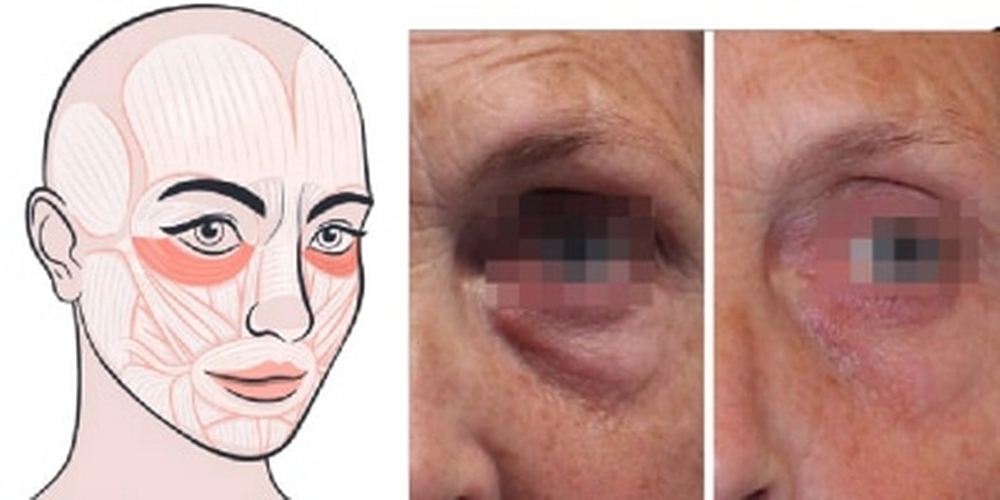 look-younger-healthier